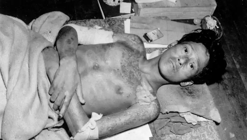 80 Yıl Önceki Felaketle İlgili Endişeler: Nagasaki'den Uyarılar