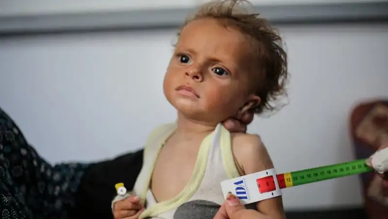 İngiltere, 300 Gazze’li Çocuğa Hayat Beklentisi Olacak